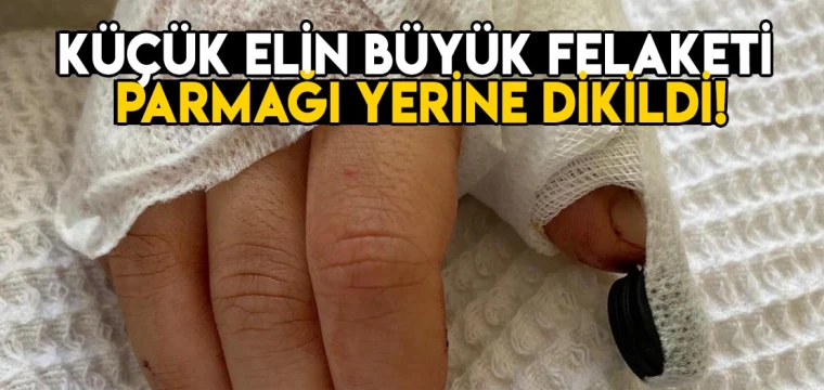 Küçük elin büyük felaketi! Parmağı yerine dikildi!