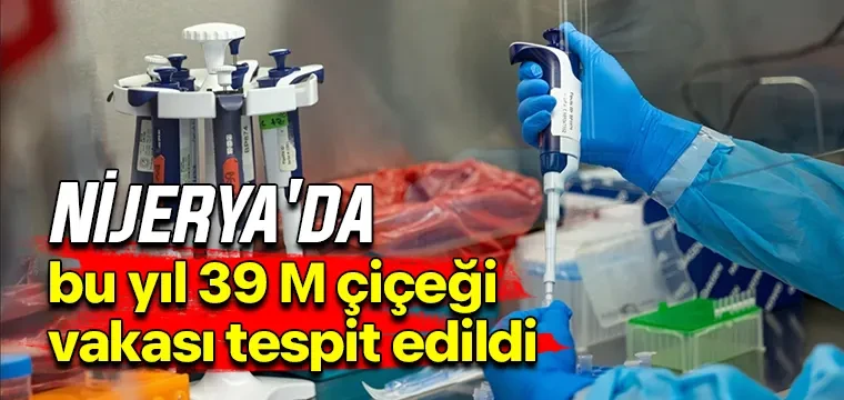 Nijerya'da bu yıl 39 M çiçeği vakası tespit edildi