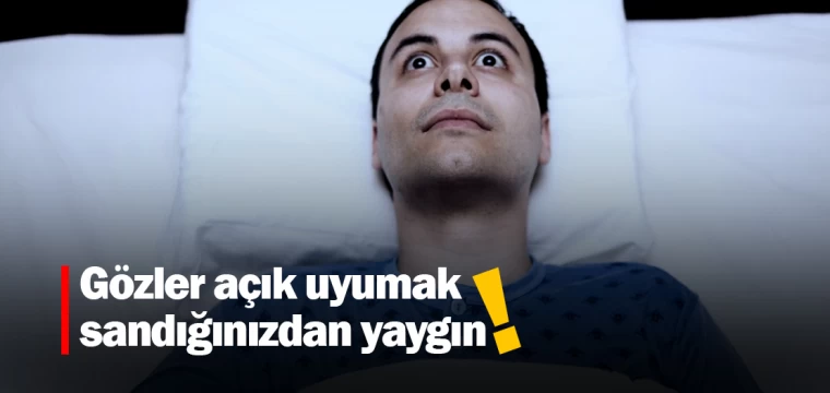 Gözler açık uyumak sandığınızdan yaygın!