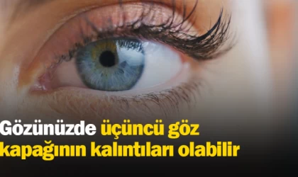 Gözünüzde üçüncü göz kapağının kalıntıları olabilir